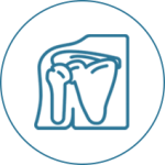 ANKYLOSIS SPONDYLITIS ANKYLOSIS SPONDYLITIS