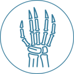 Rheumatoid Arthritis Rheumatoid Arthritis